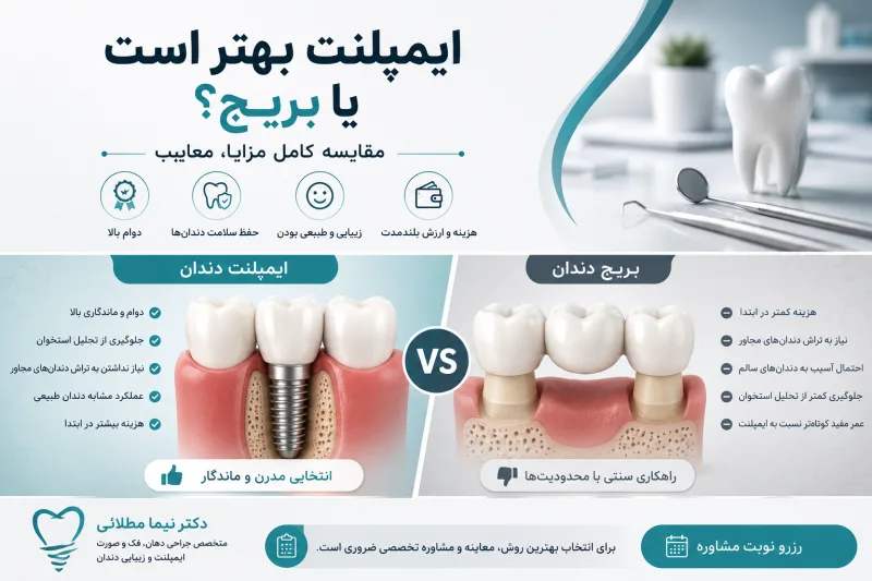 ایمپلنت بهتر است یا بریج