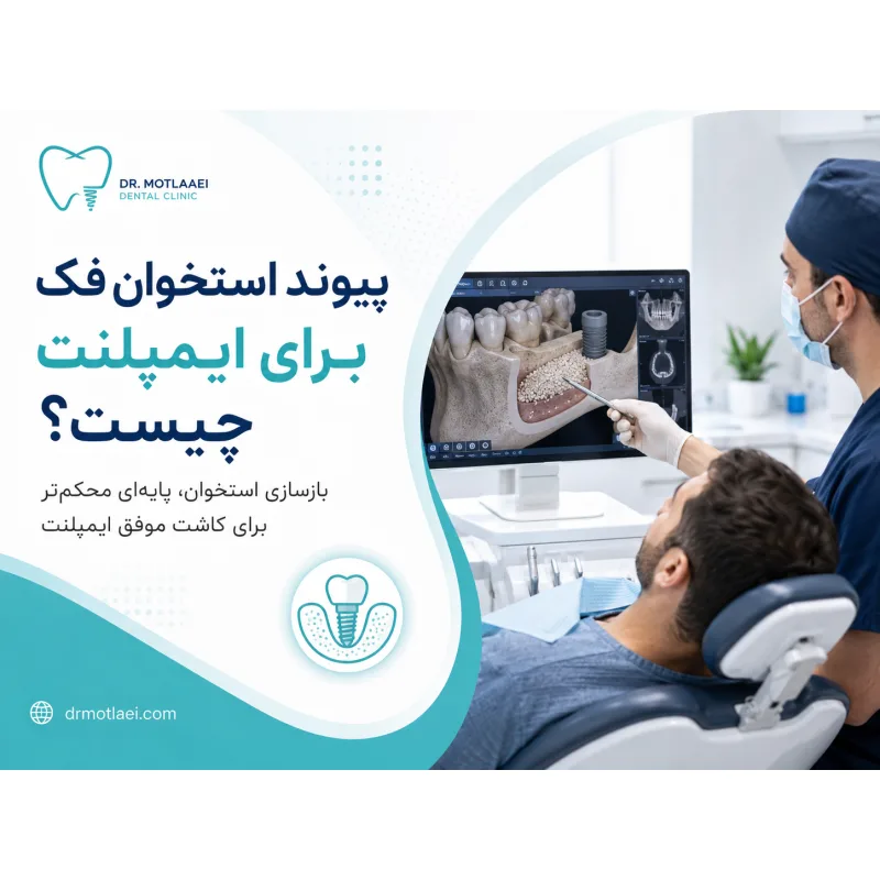 پیوند استخوان فک برای ایمپلنت چیست؟ مراحل، انواع و دوره نقاهت