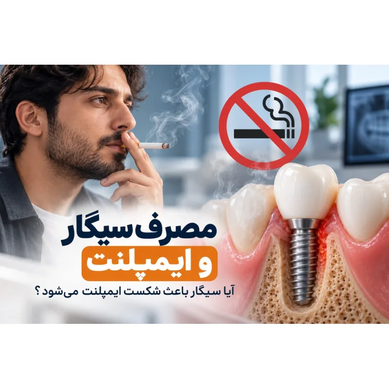 مصرف سیگار و ایمپلنت؛ آیا سیگار باعث شکست ایمپلنت می‌شود؟