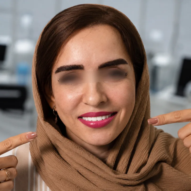 بعد از درمان بازسازی لبخند با ایمپلنت