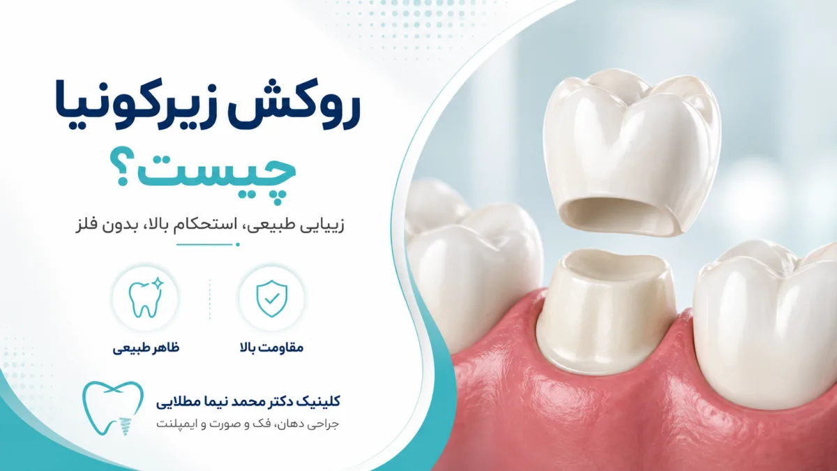 روکش زیرکونیا چیست؟ مزایا، معایب، هزینه و طول عمر روکش دندان زیرکونیا