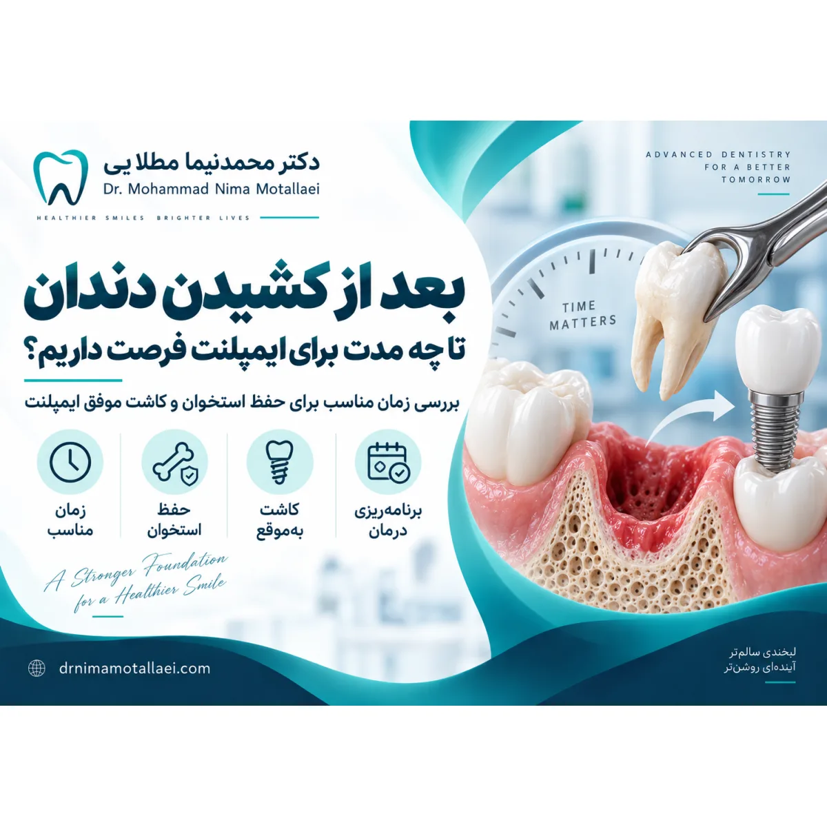 بعد از کشیدن دندان تا چه مدت برای ایمپلنت فرصت داریم؟ راهنمای کامل بهترین زمان کاشت ایمپلنت