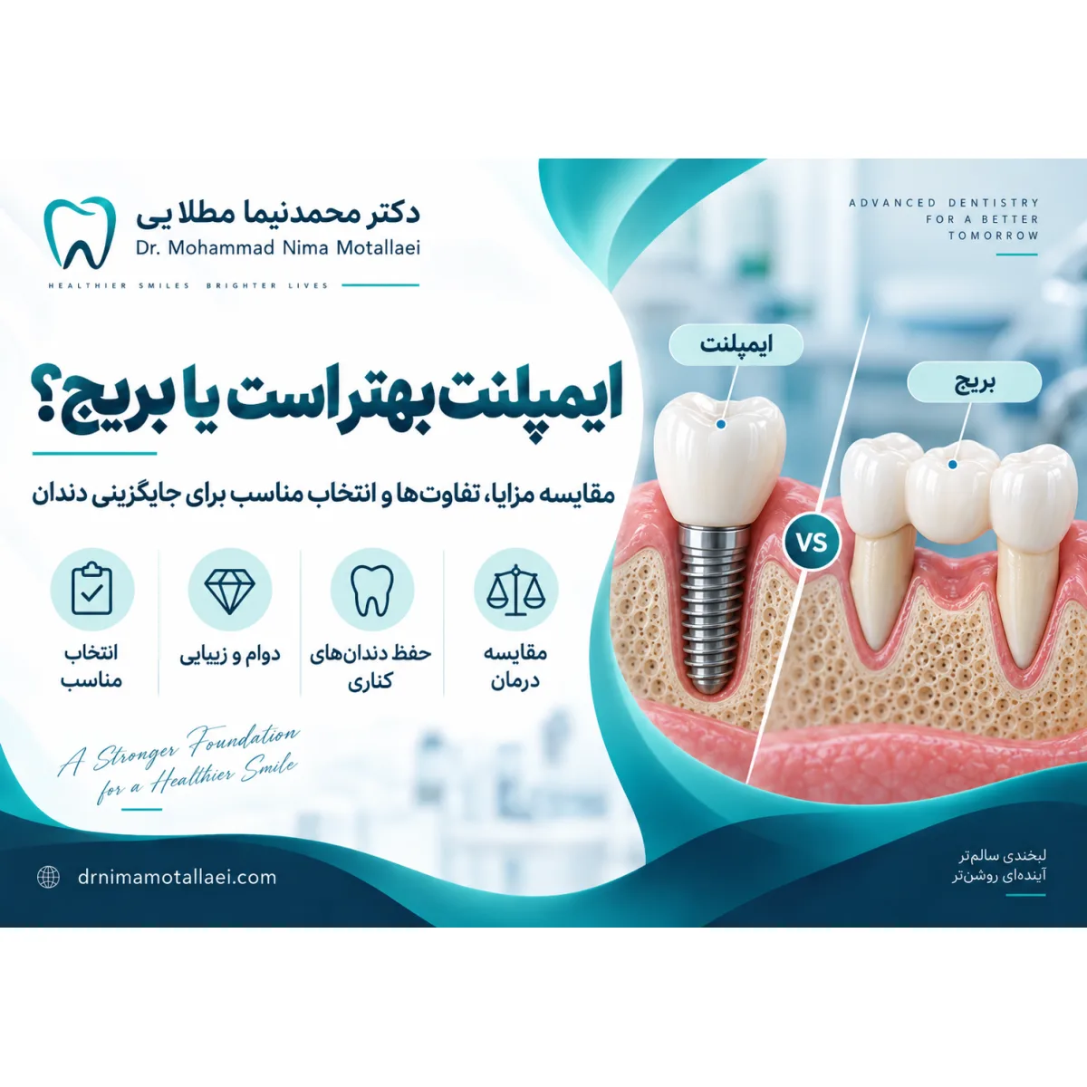 ایمپلنت بهتر است یا بریج؟ مقایسه کامل مزایا، معایب، هزینه و طول عمر در سال ۱۴۰۵