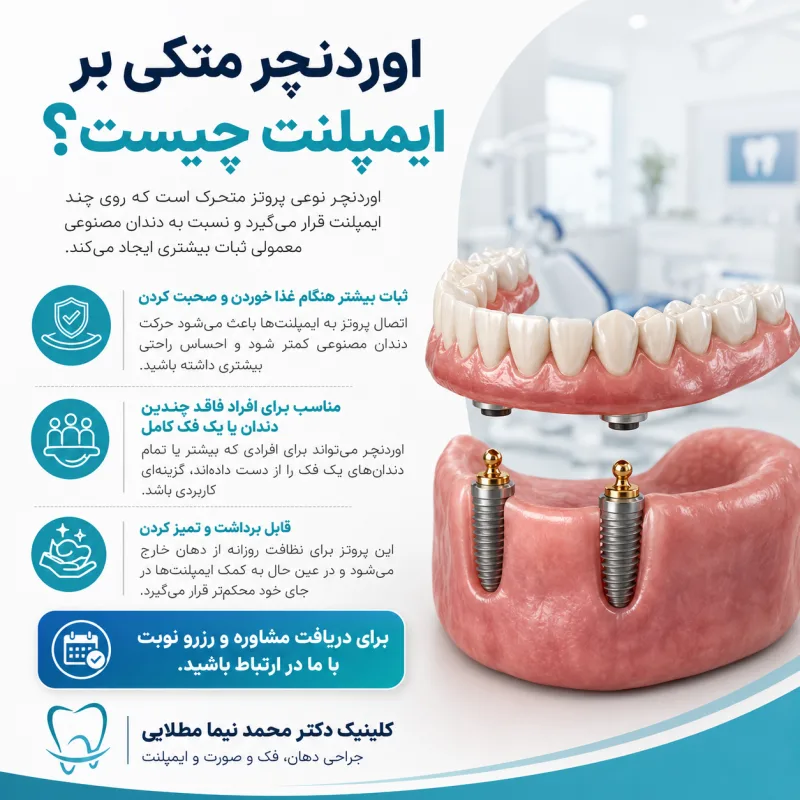 اوردنچر متکی بر ایمپلنت چیست و چه تفاوتی با دندان مصنوعی دارد؟ با مزایا، معایب، مراحل درمان، تعداد ایمپلنت، مراقبت و هزینه اوردنچر آشنا شوید.
