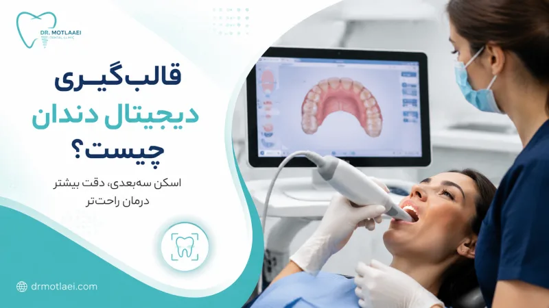 قالب‌گیری دیجیتال دندان با اسکنر داخل دهانی چیست؟ مزایا، مراحل و تفاوت با روش سنتی
