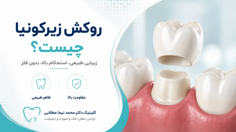 روکش زیرکونیا چیست؟ مزایا، معایب، هزینه و طول عمر روکش دندان زیرکونیا