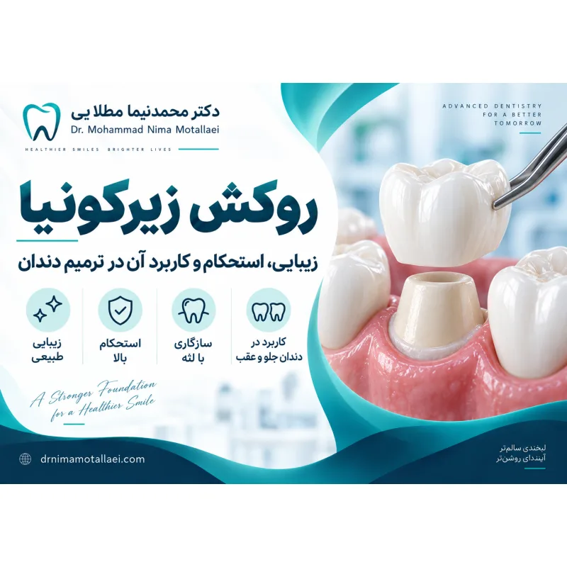 روکش زیرکونیا چیست؟ مزایا، معایب، هزینه و طول عمر روکش دندان زیرکونیا