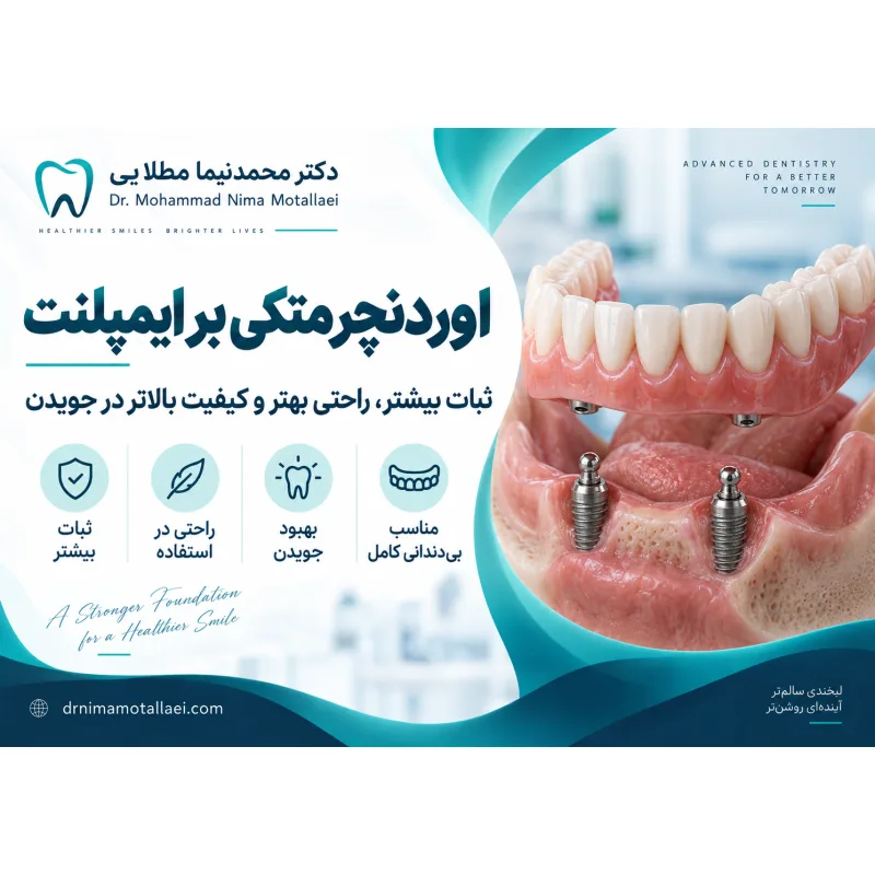 اوردنچر متکی بر ایمپلنت چیست و چه تفاوتی با دندان مصنوعی دارد؟ با مزایا، معایب، مراحل درمان، تعداد ایمپلنت، مراقبت و هزینه اوردنچر آشنا شوید.