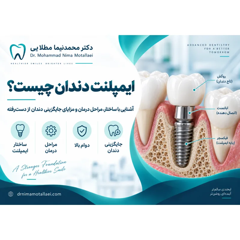 ایمپلنت دندان چیست؟ راهنمای کامل مزایا، مراحل درمان، هزینه و مراقبت‌ها