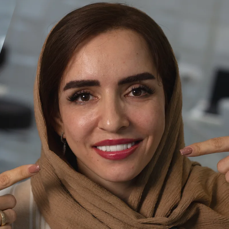 بعد از درمان دندان ایمپلت-بعد از جراحی